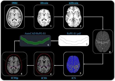 MRI-Guided Regional Personalized Electrical Stimulation in Multisession and Home Treatments